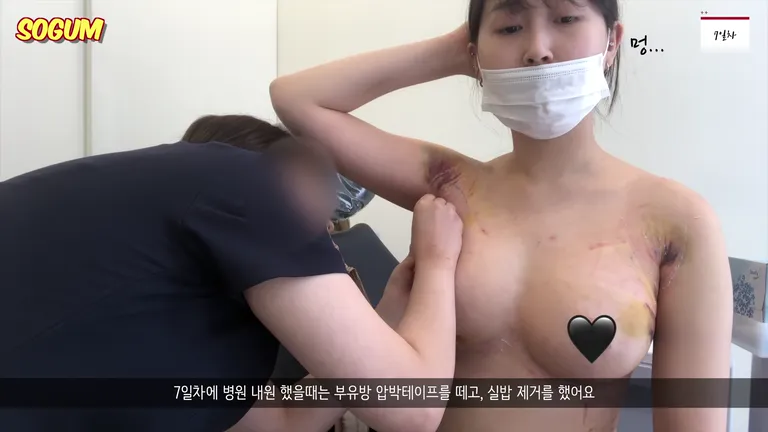 가슴 성형 업로드 하다가 얼마 못가서 짤린 유튜버 박소금 02화